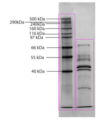 Gel Molecular Weight Analyzer 02.png