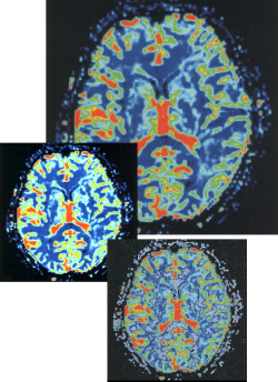 1Image adjustment example 2.png