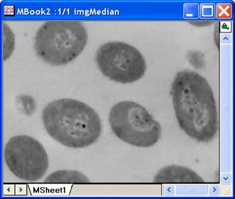 ImgMedian help English files image006.jpg