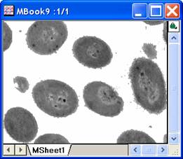 Image:imgThreshold_help_English_files_image006.jpg Image:imgThreshold_help_English_files_image006.jpg